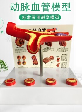 教学仿真血管模型活动血管阻塞模型血栓病变标本4阶段性动脉O硬化