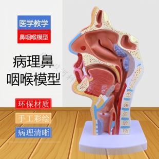病态鼻咽喉模型医用鼻腔解剖呼吸道模型喉咙带肌肉血管神经甲状腺