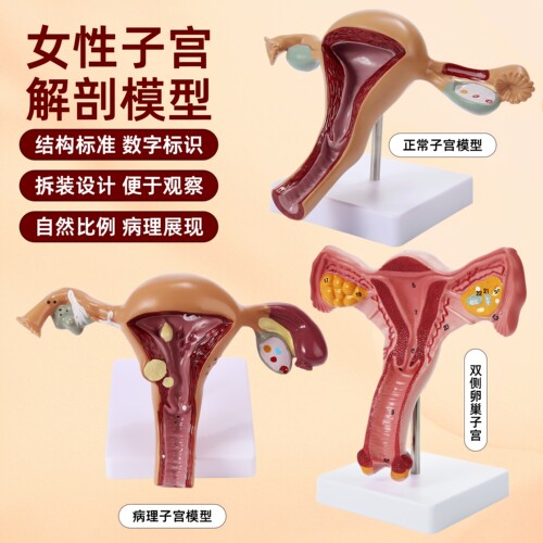 医用生殖器官解子宫卵巢妇科模型