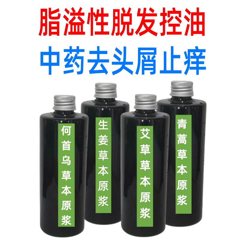 去屑止痒洗发水正品去头屑排行榜第一名脂溢性脱发控油防中药脱发