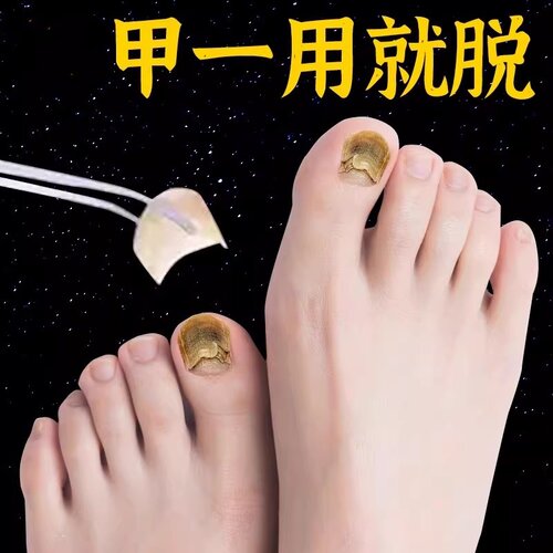 日本森之川惠药业坏甲护理液 滴一滴  长新甲 享受好甲生活