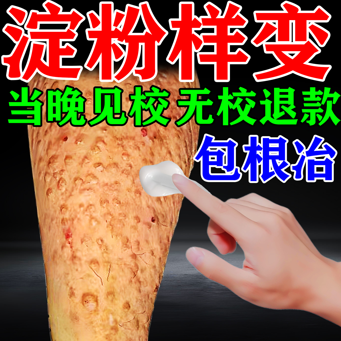 治疗顽固皮肤淀粉样变苔藓斑状膏