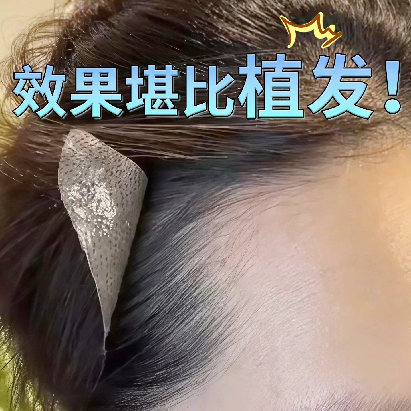 小七【前额加宽】发际线假发片