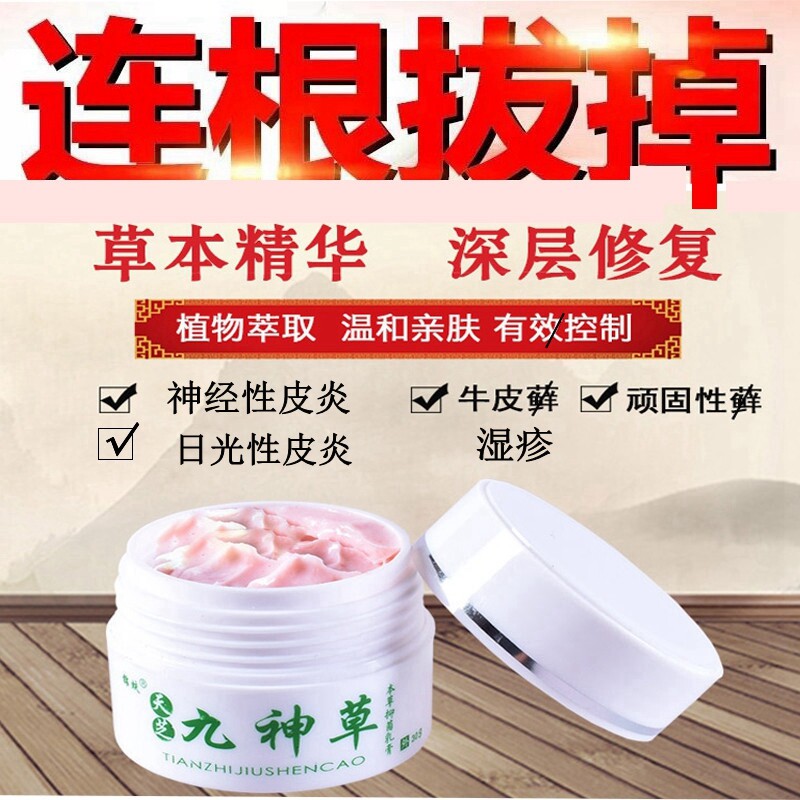 神经性顽固日光神经性皮炎膏进口止痒过敏外用无激素牛皮癣无激素