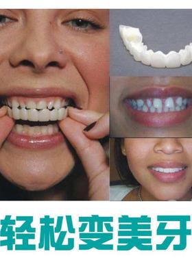 Silicone Upper  Lower False Teeth Veneers Dentures Fake