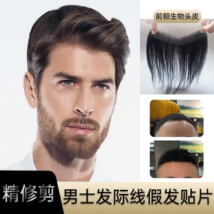 发际线假发片贴男隐形无痕前额后移M型刘海片生物头皮真发补发片