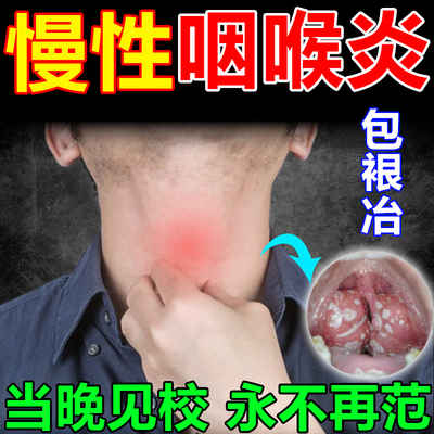 咽炎慢性咽炎除根喷雾剂润喉梨膏糖治疗烟喉炎有异物感专用药无糖