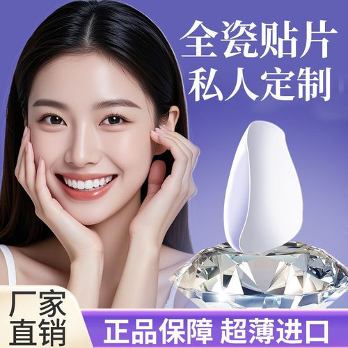 全瓷贴面超薄义获嘉牙贴进口贴片私人订制全瓷牙齿贴面美白瓷贴面