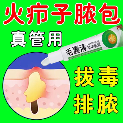 脓包溃烂疖子拔毒流白红肿硬块