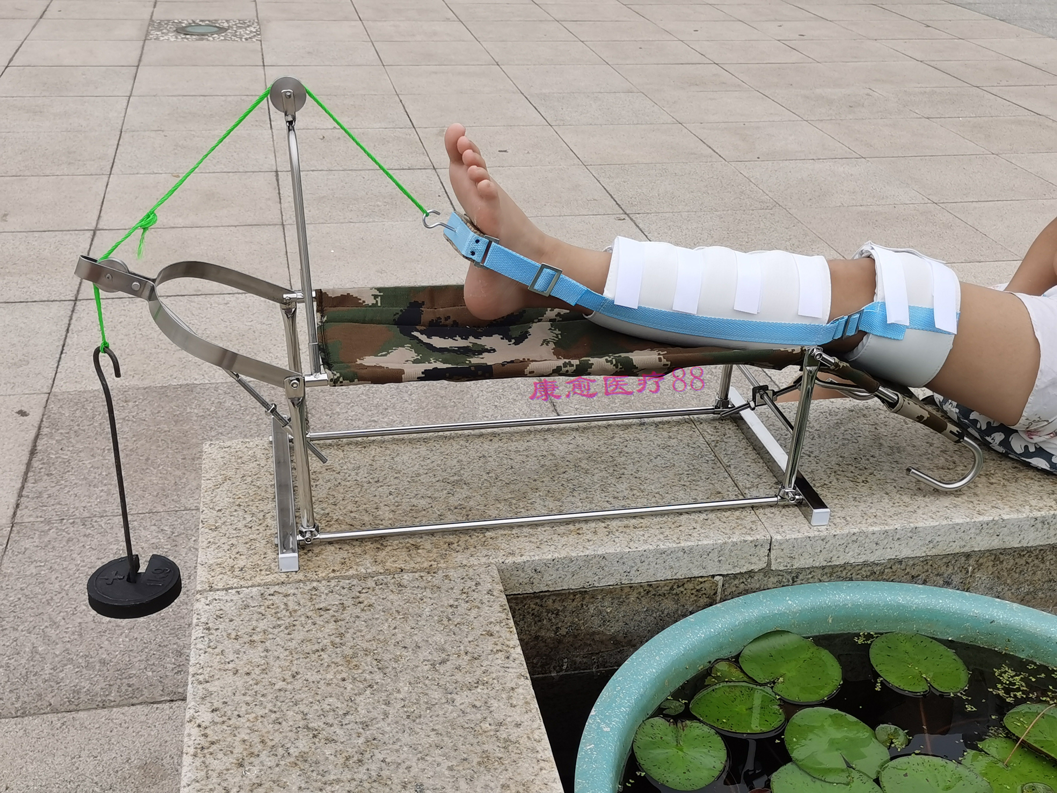 腿部牵引架髋关节股骨膝盖踝骨骨折牵引复位勃朗氏下肢皮牵引拉伸