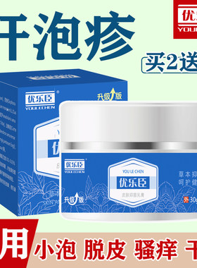 汗泡疹手脱皮干裂乐臣止痒膏