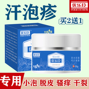 [2送1]汗泡疹手痒止痒膏脚手脱皮小泡干裂汗疱宁湿痒优乐臣抑菌膏
