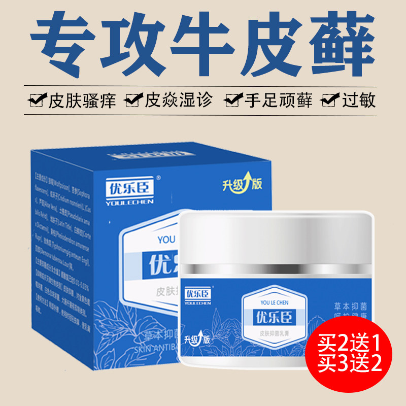 优乐臣汗泡宁抑菌膏牛皮藓专用手藓脚藓股藓大腿内侧皮肤痒止痒膏