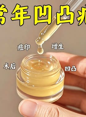【增强版】去疤膏老手术疤凹凸摔伤增生疤痘印消疤修复膏