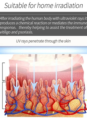 311nmUVB ultraviolet light therapy instrument, laser treatm
