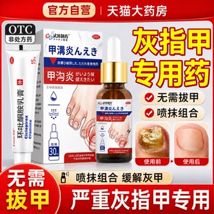 治疗灰指甲专用药特环吡酮胺乳膏真菌感染药膏正品旗舰店di一名