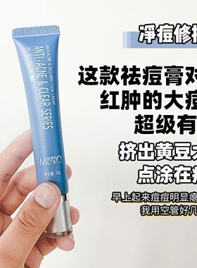 瓷妆祛痘膏痘印修复膏去黑头粉刺控油灭痘印痘疤净痘精华乳精华霜