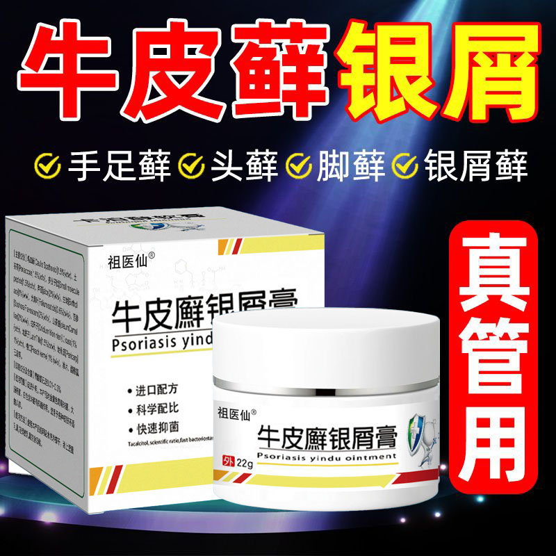 祖医仙牛皮银屑膏好用