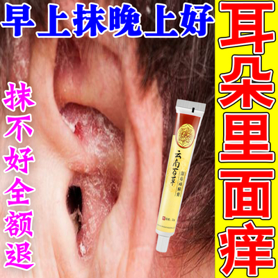 耳朵痒止痒抑菌治疗耳朵里面痒烂外耳道湿疹耳廓干燥起皮消炎的药