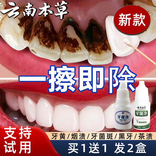 【买一送一】烟渍黄牙黑点牙斑净