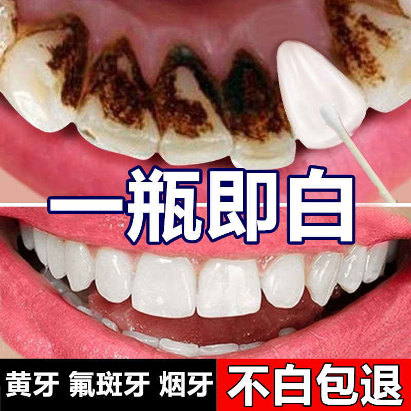 屈臣氏牙斑净牙齿美白速效去黄牙液洗污垢烟渍茶渍牙菌斑祛除神器
