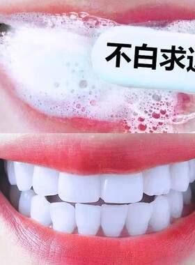 胖东来爆款牙膏速效去黄口臭