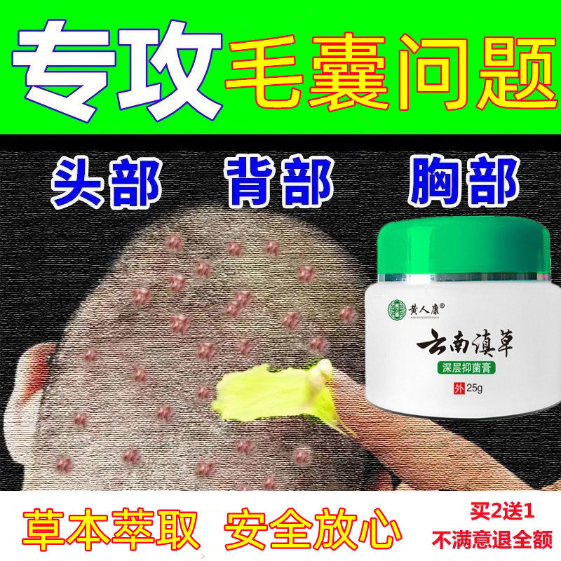 头部头皮毛囊身体头上长痘痘腿脸部背部私处毛囊克星专用膏