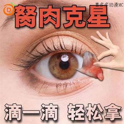 100%眼角胬肉眼角息肉翼状息肉异物感看不清楚洗眼液