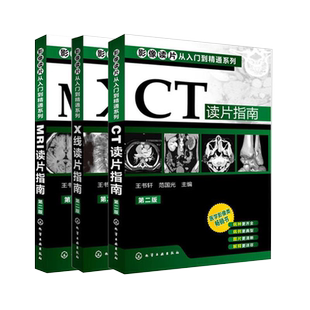 正版4本影像读片从入门到精通系列第三版CT读片指南+MRI读片指南+超声读片指南+X线读片指南医学超声影像诊断图谱影像检查技术教程