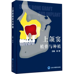 正版 上颌窦植骨与种植书 林野 主编 口腔种植学书籍和牙手术学图解美学区域的修复精准植入技巧数字化实用技术精要现代牙科牙体