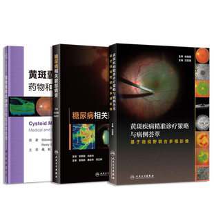 正版3本 黄斑疾病精准诊疗策略与病例荟萃+糖尿病相关眼部病变+黄斑囊样水肿的药物和手术处理 GASS黄斑病学图谱 眼底视网膜疾病书