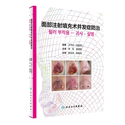 面部注射填充术并发症防治