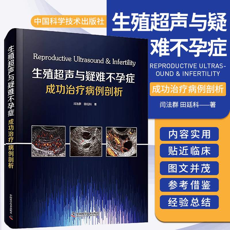 生殖超声与疑难不孕症成功治疗