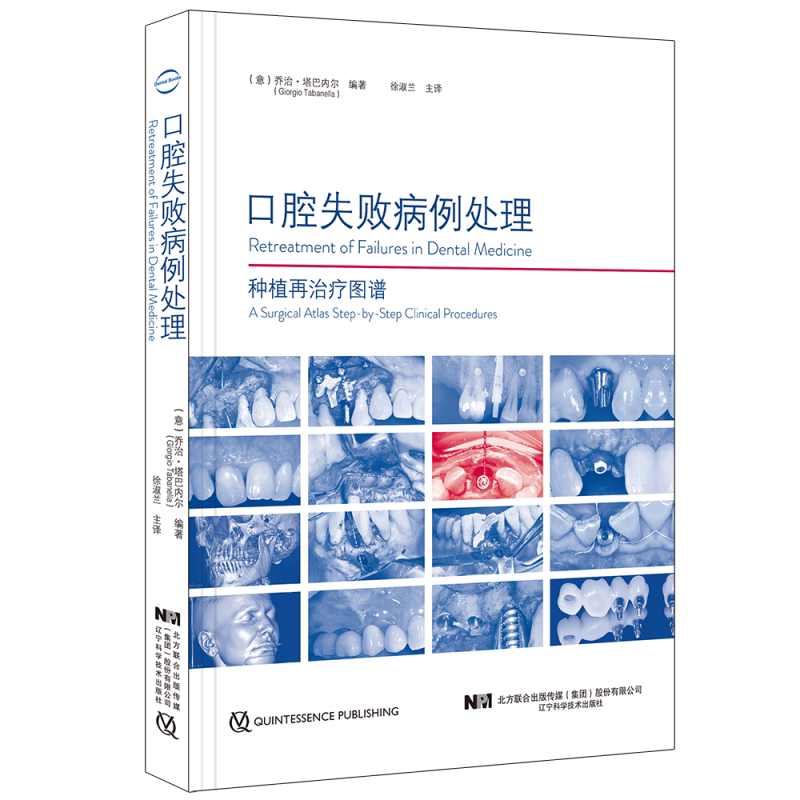 全新正版 口腔失败病例处理种植再治疗图谱 徐淑兰现代口腔医学医源性治疗失败传播口腔种植知识 辽宁科学技术出版社9787559116932