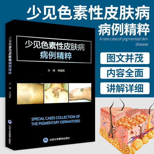 正版 少见色素性皮肤病病例精粹 常建民 主编 北京大学医学出版社 9787565922145 皮肤病学 皮肤科 图鉴 大全 皮肤病书籍