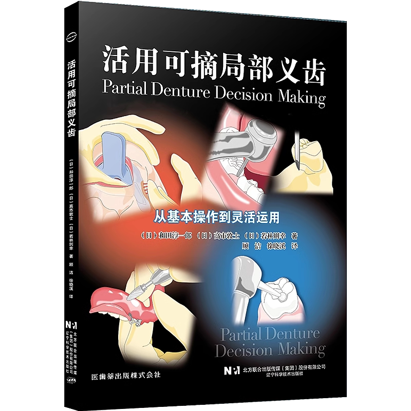 包邮正版 活用可摘局部义齿 从基本操作到灵活运用 顾洁 徐晓溪 主译 可摘局部义齿的引入 卡环出现松动 等病例解析 9787559131348