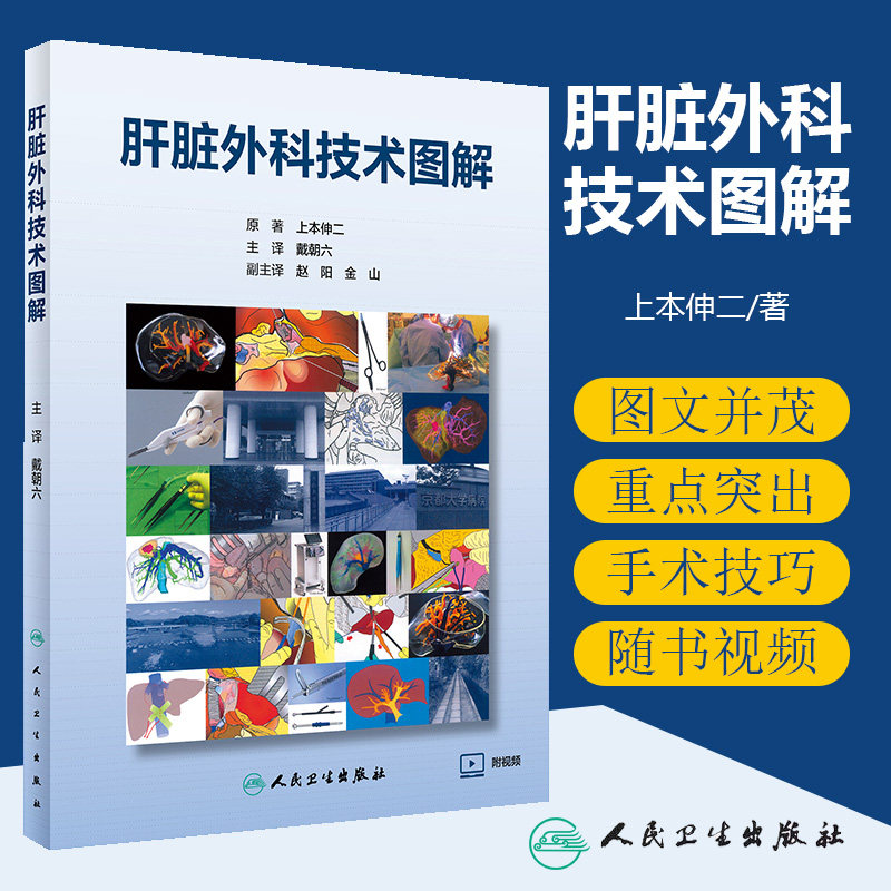 肝脏外科技术图解 附赠10个视频 上本伸二 戴朝六 肝胆胰移植外科学检查围手术期管理切除技术肝脏外科手术学幕内 人民卫生出版社