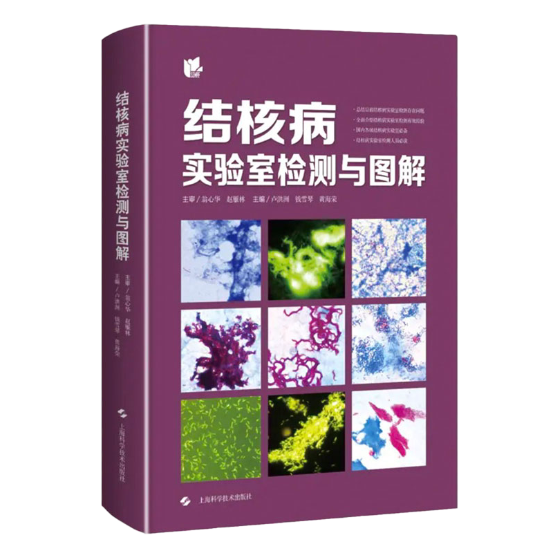 正版 结核病实验室检测与图解 卢洪洲 等编 专门介绍目前结核病检测技术关键细节 操作注意事项 上海科学技术出版社 9787547853443