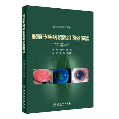 正版 眼前节疾病裂隙灯图像解读 眼表疾病临床系列 裂隙灯照相技术 眼睑疾病检查实用指南 眼前节照相方法 眼科学 人民卫生出版社