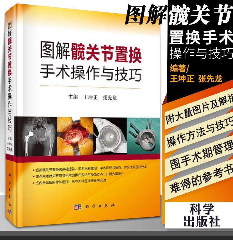 正版 图解髋关节置换手术操作与技巧 王坤正 张先龙 主编 髋关节置换基础理论书临床医学微创技术书籍 科学出版社9787030656667