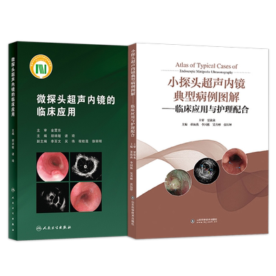微探头超声内镜的临床应用