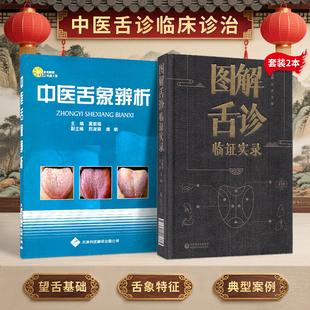 正版2本图解舌诊临证实录+中医舌象辨析舌诊书图解舌诊断病伸伸舌头把病解入门图谱教程中医养生书籍舌像舌苔辨析临床病症望舌诊病
