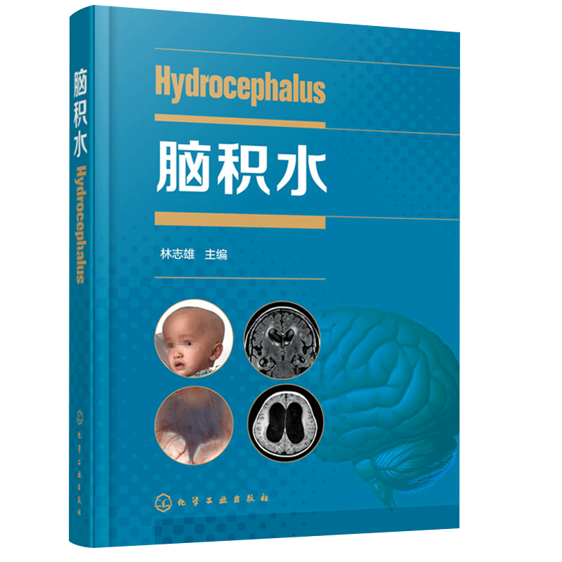 正版 脑积水 林志雄 脑手术技巧 神经外科颅底手术入路 显微外科神经内镜 脑血管 脑外科颅脑损伤 神经外科学书籍 9787122370945