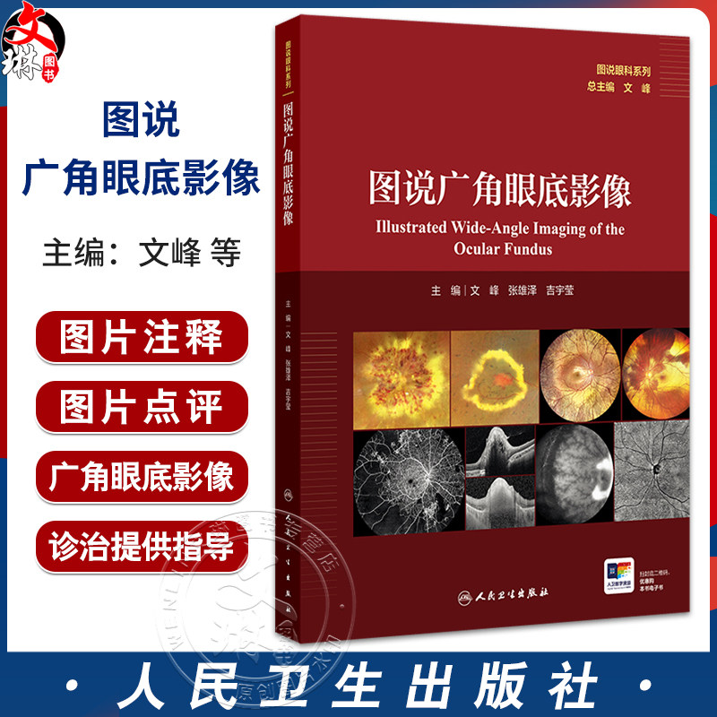 图说广角眼底影像 主编文峰 张雄泽 吉宇莹 遗传性视网膜脉络膜病变 眼底炎症与感染 视网膜血管性疾病9787117370912人民卫生出版