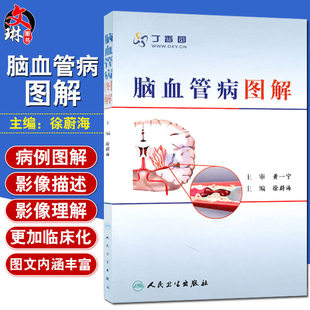 人民卫生出版 社 丁香园医学参考书籍 正版 脑血管病基础知识 徐蔚海主编 脑血管治疗学医学工具书籍 临床经验 脑血管病图解