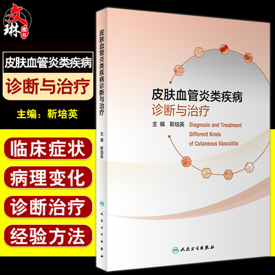 皮肤血管炎疾病诊断治疗