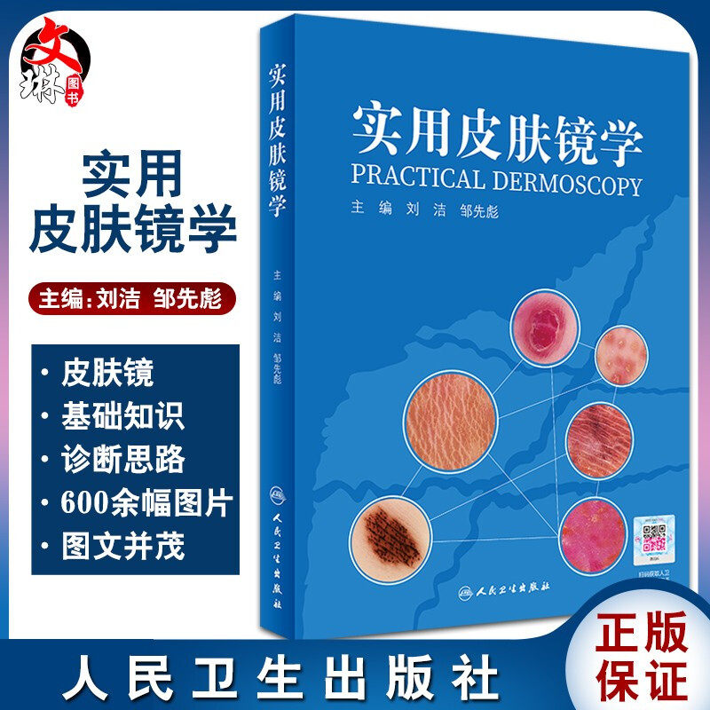实用皮肤镜学 人卫刘洁邹先彪黑色素瘤脂溢性角化血管瘤银屑病黄褐斑协和皮肤镜图谱皮肤性病学人民卫生出版社9787117307871