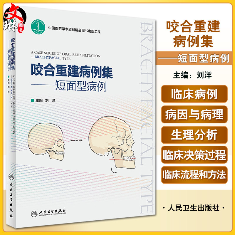 咬合重建病例集短面型病例刘洋
