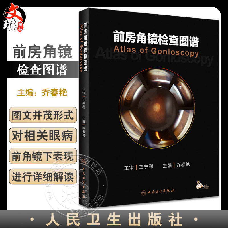 前房角镜检查图谱眼科基本检查