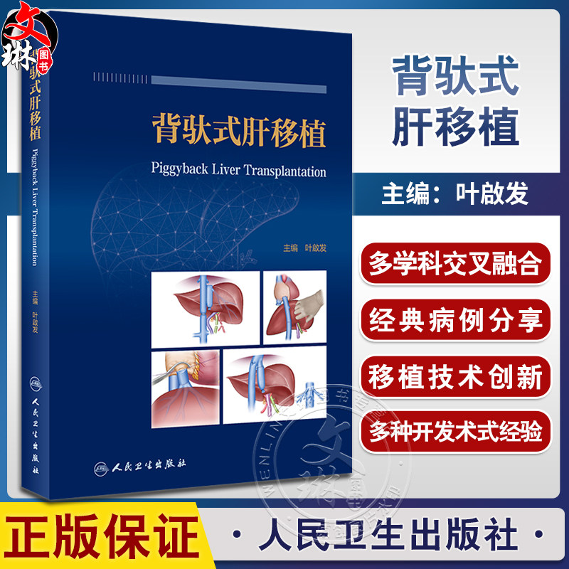 背驮式肝移植叶啟发主编
